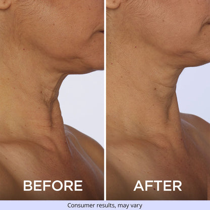 Neck Tightening Cream